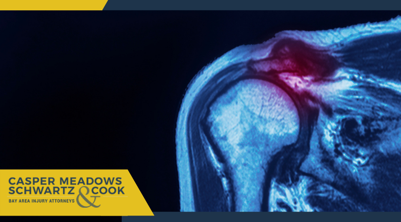 What Happens If You Don’t Fix A Rotator Cuff Tear? - Casper, Meadows 